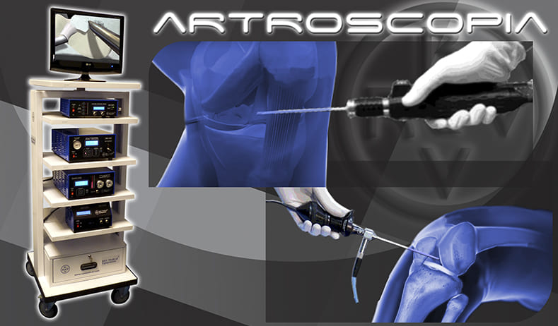 Equipos Torre Artroscopia - Perforador Ortopédico